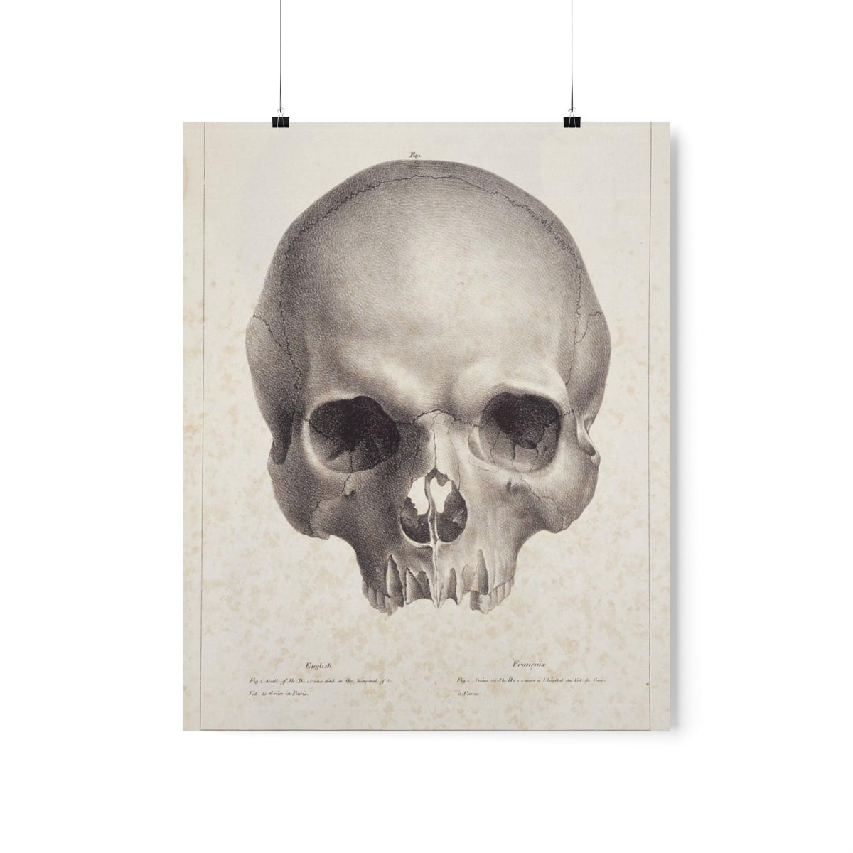 Joseph Vimont - Human Skull Print Poster