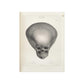 Joseph Vimont - Skull Of A Hydrocephalus Child Print Poster