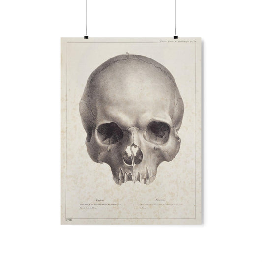 Joseph Vimont - Human Skull Print Poster